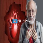 협심증 예방수칙 5가지와 최신 치료방법들