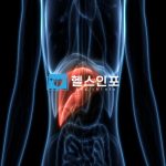담낭암의 정의와 예방수칙7가지 그리고 효과적인 치료법