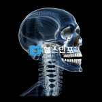 감기와 비슷해 놓치기 쉬운 뇌수막염ㅣ다양한 증상과 5가지 주요원인