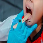 편도염의 주요증상과 원인들