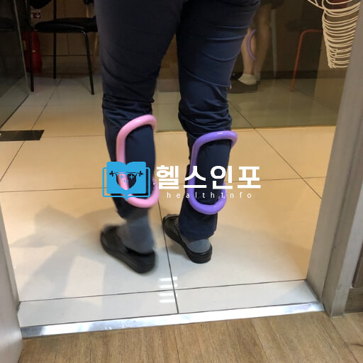 다리 건강의 적신호, 하지정맥류의 예방과 최신 치료법