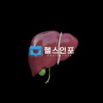 오른쪽옆구리통증 담석증 증상 의심부터! 담석증 8가지 증상과 주요원인 분석