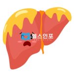놓치기 쉬운 지방간의 6가지 주요증상과 주요원인들