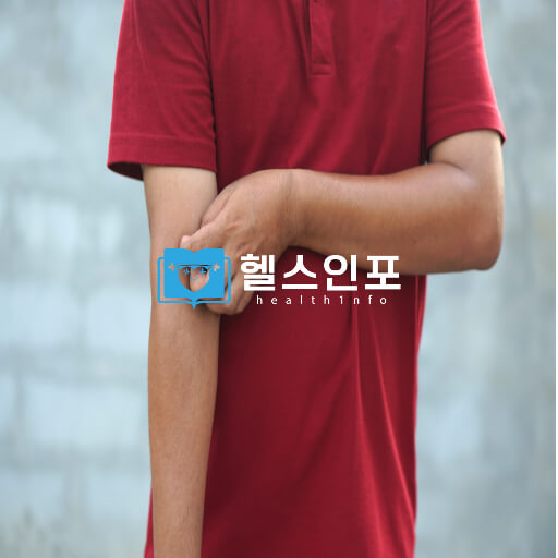 아토피 피부염 증상과 그 배후에 숨겨진 원인, 그리고 효과적인 예방 및 치료법