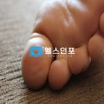 발바닥 뒤꿈치 통증, 족저근막염 12가지 증상 총정리