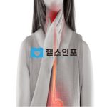 식도암 원인과 증상, 그리고 예방법