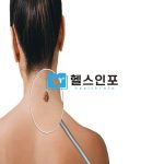 피부암에 대한 오늘의 진실: 진단, 예방, 그리고 효과적인 치료!