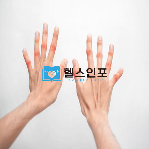 류마티스 관절염