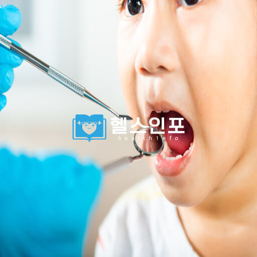 충치에 대한 올바른 이해ㅣ9가지 주요증상과 원인