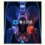 여자 골반염증상, 원인 및 자가 관리법