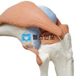 거위발건염 올바른 치료법 6단계 및 예방법