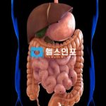 희귀암 기스트암 기스트암 증상 기스트암 원인