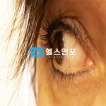 결막모반 꼭 제거해야 하는걸까? 결막모반의 원인과 제거의 필요성
