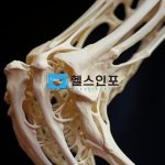 육종암의 종류와 증상,원인부터 치료방법까지