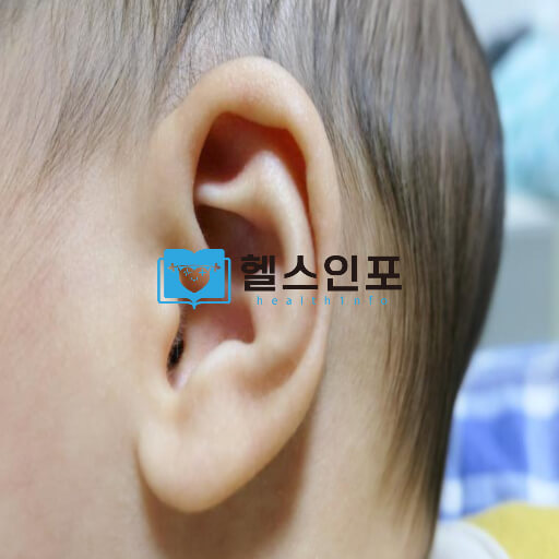 한쪽 귀 먹먹한증상 원인 - 청각 신경 문제