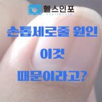 손톱 세로줄 원인