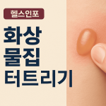 화상 물집 터트리기
