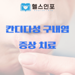 칸디다성 구내염