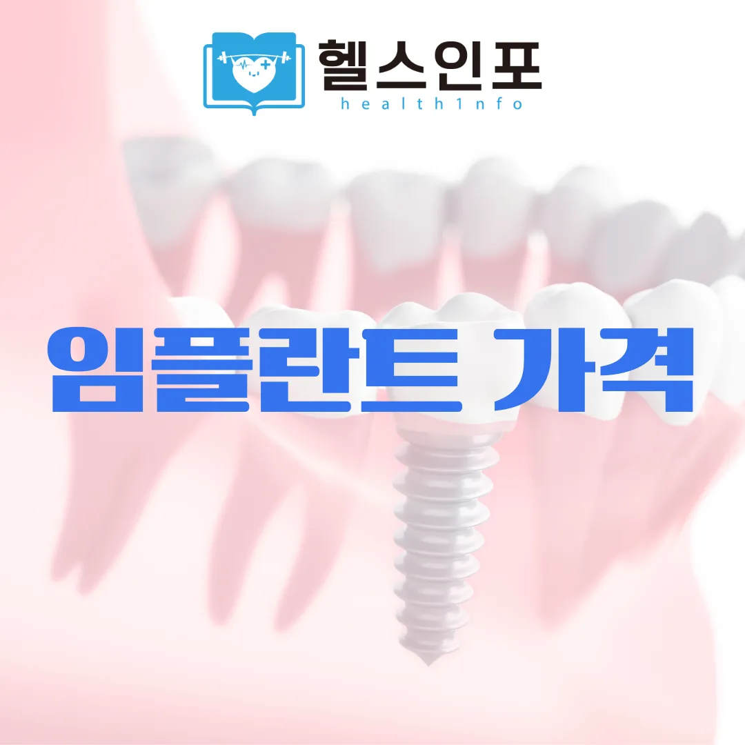 임플란트 가격