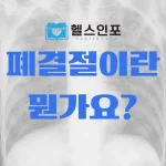 폐결절이란 뭔가요