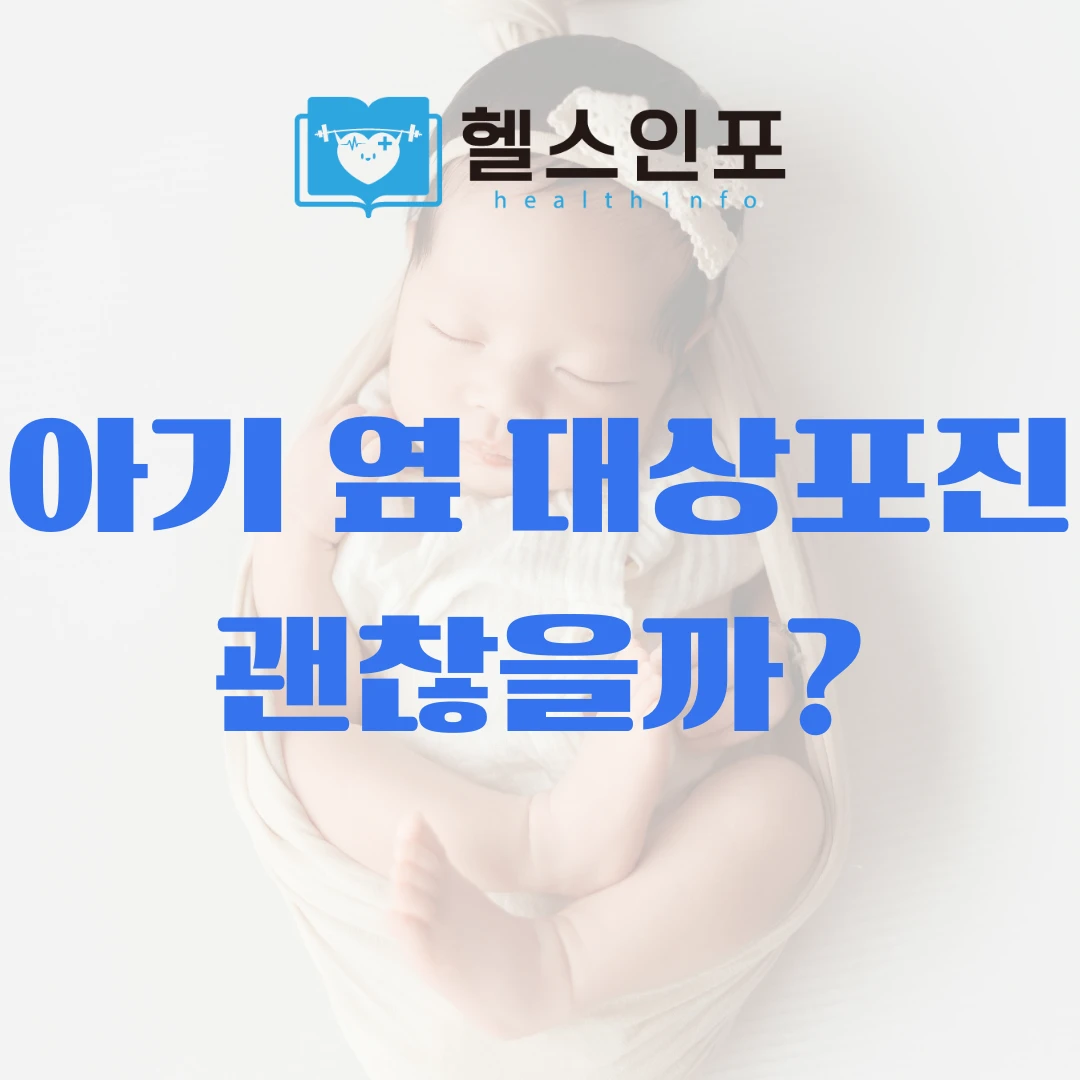 대상포진 전염성 아기