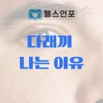 다래끼 나는 이유